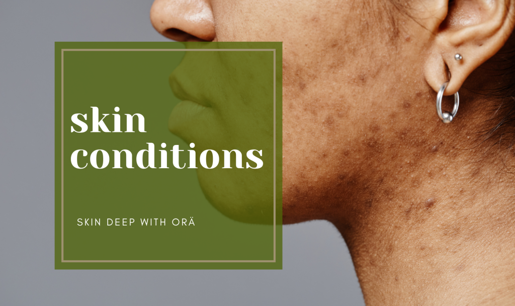 Hyperpigmentation/Scar Solutions