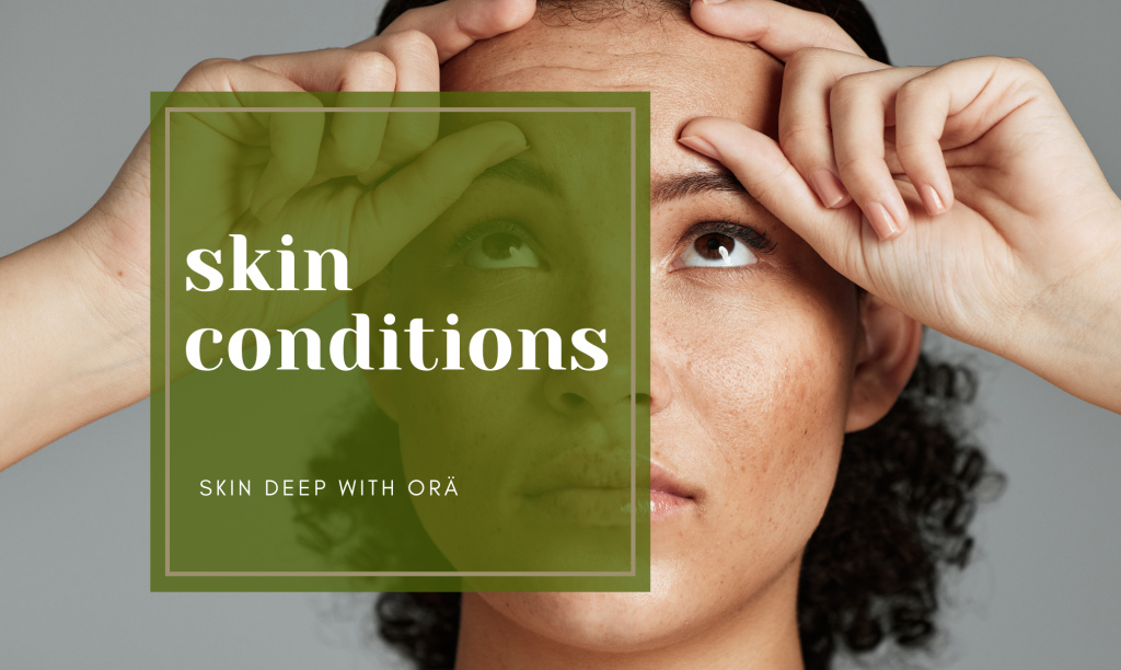 Aging/Wrinkle Solutions